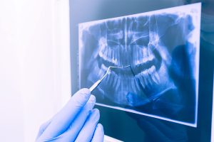 Extensão Radiologia Odontológica