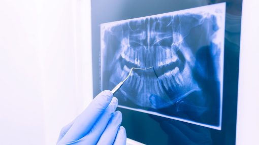 Extensão Radiologia Odontológica
