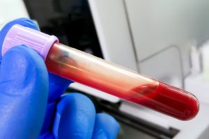 Hematologia Clínica e Citológica
