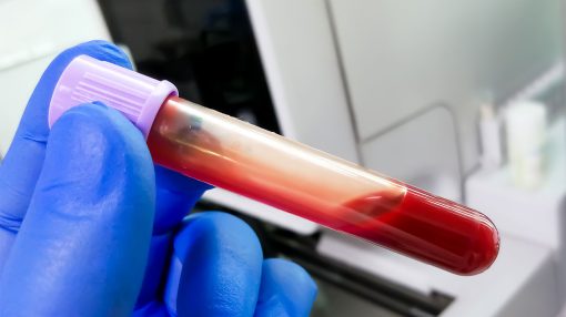 Hematologia Clínica e Citológica